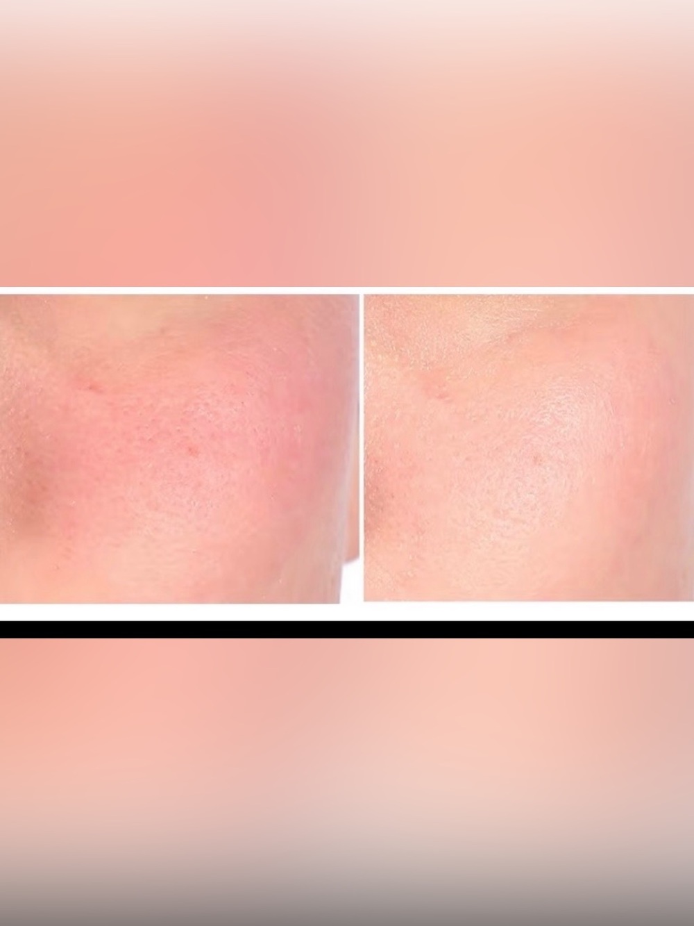 Nakery Beauty Soothing Face and body wash for Eczema, dryness, & redness New - Picture 7 of 7